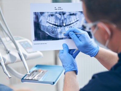 dental care in Beverly Hills