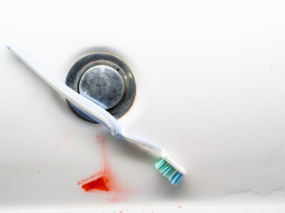 gum disease