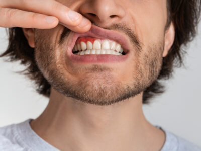 gum disease