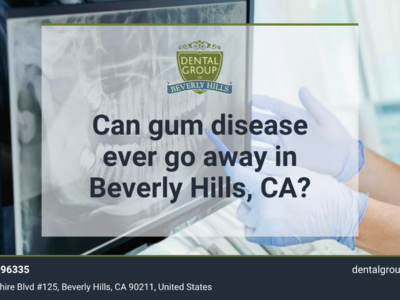Can gum disease ever go away in Beverly Hills, CA