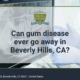 Can gum disease ever go away in Beverly Hills, CA