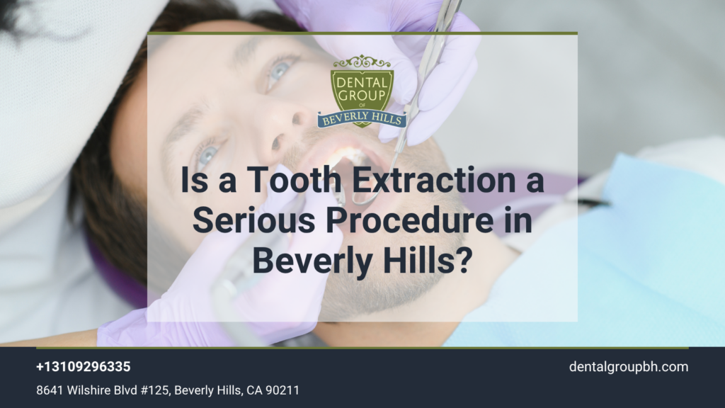 Is a Tooth Extraction a Serious Procedure in Beverly Hills
