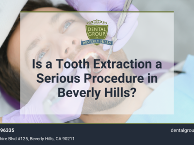 Is a Tooth Extraction a Serious Procedure in Beverly Hills