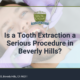 Is a Tooth Extraction a Serious Procedure in Beverly Hills